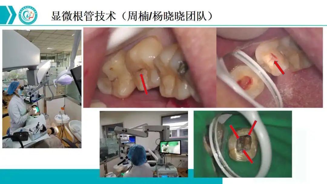 口腔健康新突破：扁平苔藓研究迎来曙光