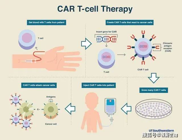 “招募中：cart细胞免疫疗法最新临床试验”